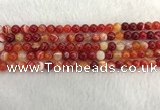 CAA1911 15.5 inches 6mm round banded agate gemstone beads