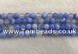 CAA2334 15.5 inches 10mm round banded agate gemstone beads