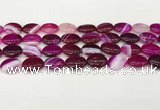 CAA4655 15.5 inches 12*16mm oval banded agate beads wholesale