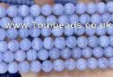 CAA5277 15.5 inches 8mm round natural blue lace agate beads