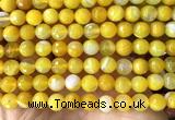 CAA6311 15 inches 8mm faceted round yellow banded agate beads