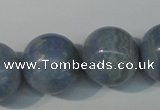 CAG4377 15.5 inches 20mm round dyed blue lace agate beads