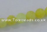 CAG7519 15.5 inches 6mm round frosted agate beads wholesale