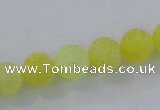 CAG7522 15.5 inches 12mm round frosted agate beads wholesale