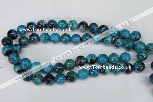 CCO166 15.5 inches 15mm round dyed natural chrysotine beads