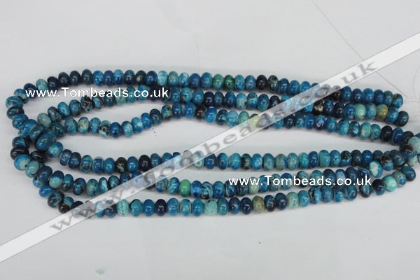 CCO170 15.5 inches 5*8mm rondelle dyed natural chrysotine beads