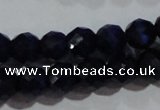 CCT368 15 inches 6mm faceted round cats eye beads wholesale