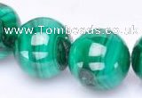 CMN29 AB grade 18mm round natural malachite beads Wholesale