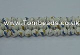 CPB592 15.5 inches 8mm round Painted porcelain beads