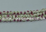 CPB745 15.5 inches 14mm round Painted porcelain beads