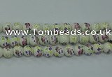 CPB772 15.5 inches 8mm round Painted porcelain beads