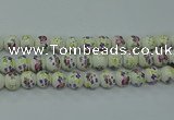 CPB772 15.5 inches 8mm round Painted porcelain beads